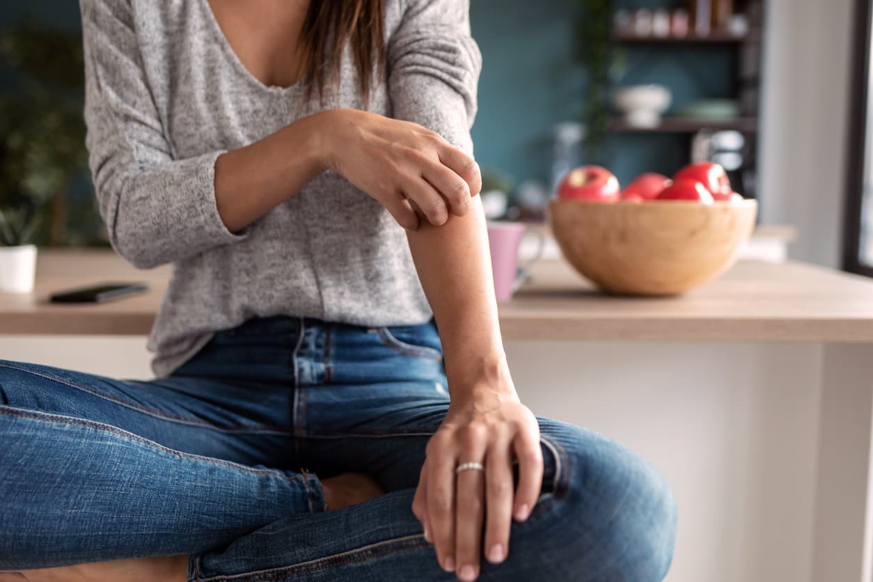 Close-up of young woman scratching her arm while sitting on the stool in the home kitchen.