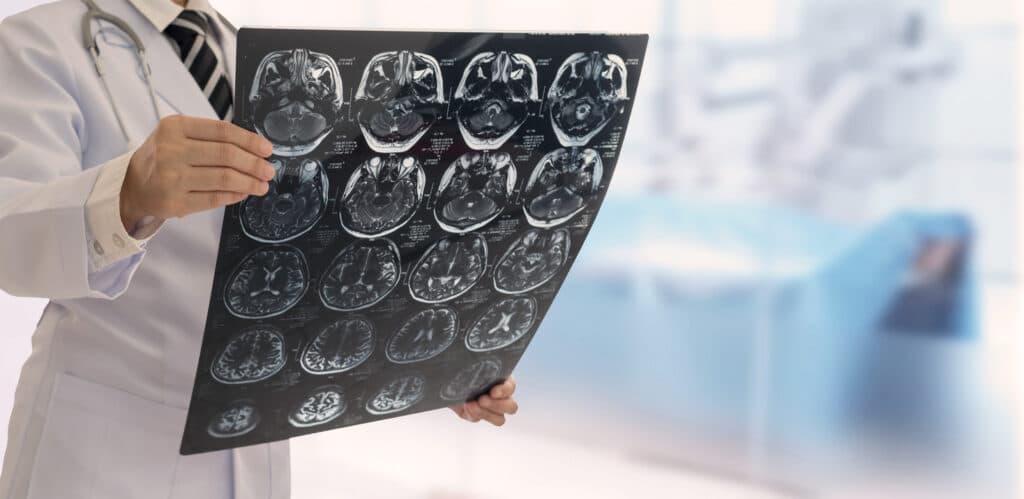 Doctor check up x-ray film of the brain by ct scan brain at patient room hospital. wide view.