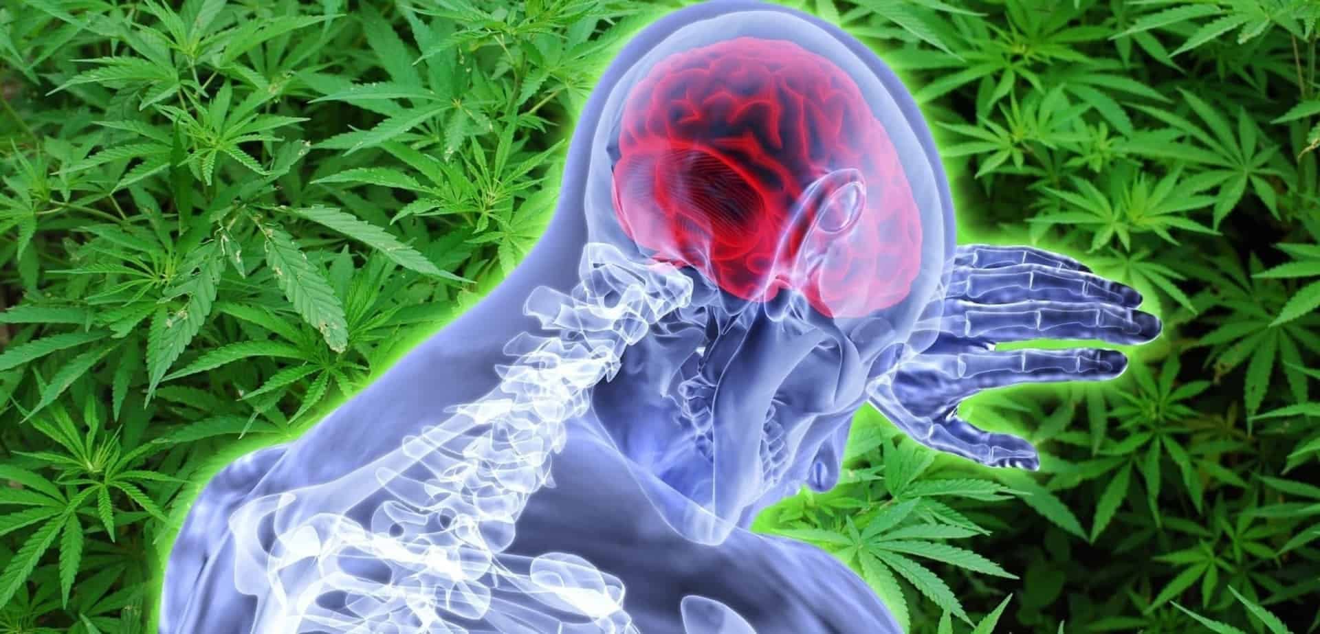 x ray image of human brain with cannabis background