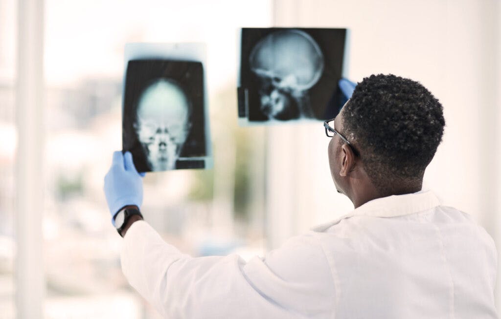 Shot of a young doctor analysing an x ray of a patient’s skull